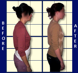 backpain-posture-chiropractor-Sydney