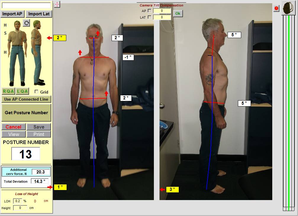 Visit a a chiropractor at North Sydney or Crows Nest Spine and Health ...